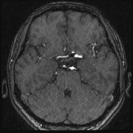 Click on the Serie image to view the images of VILLANUEVA, WILLIAM A.